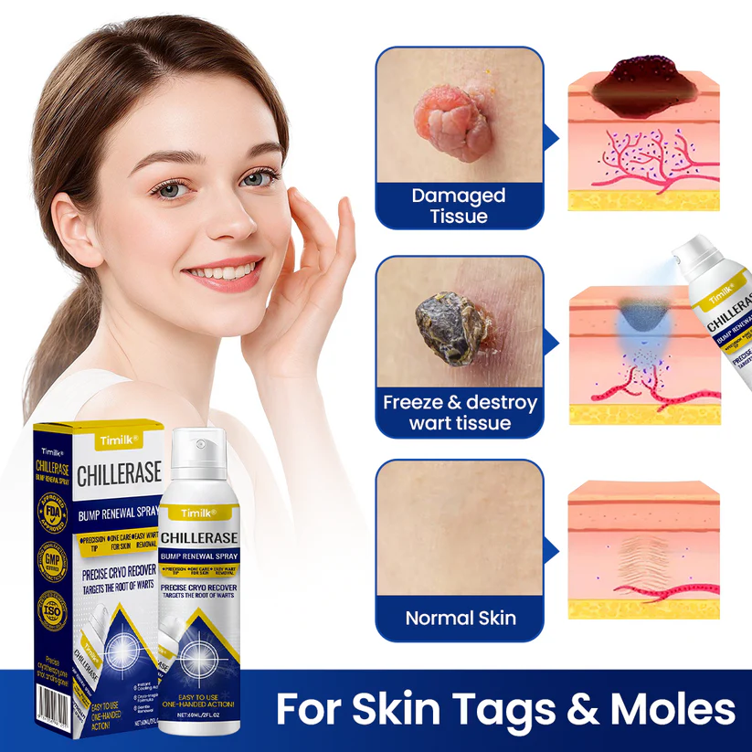 Timilk® ChillErase Bump Renewal Spray
